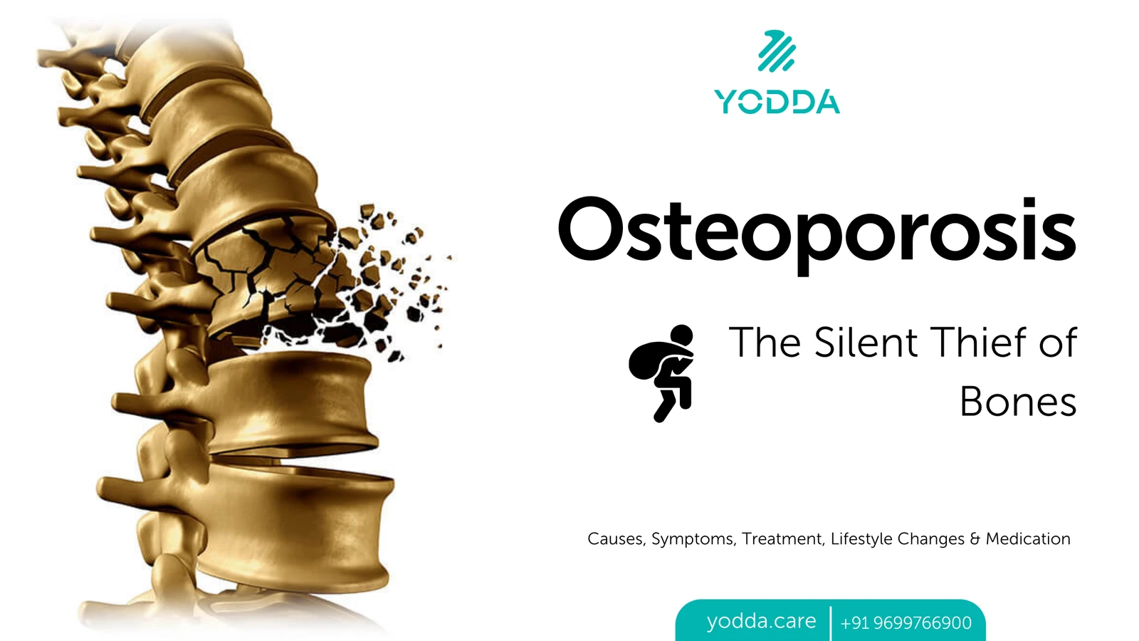 Osteoporosis: Questions About Bone Health and Support